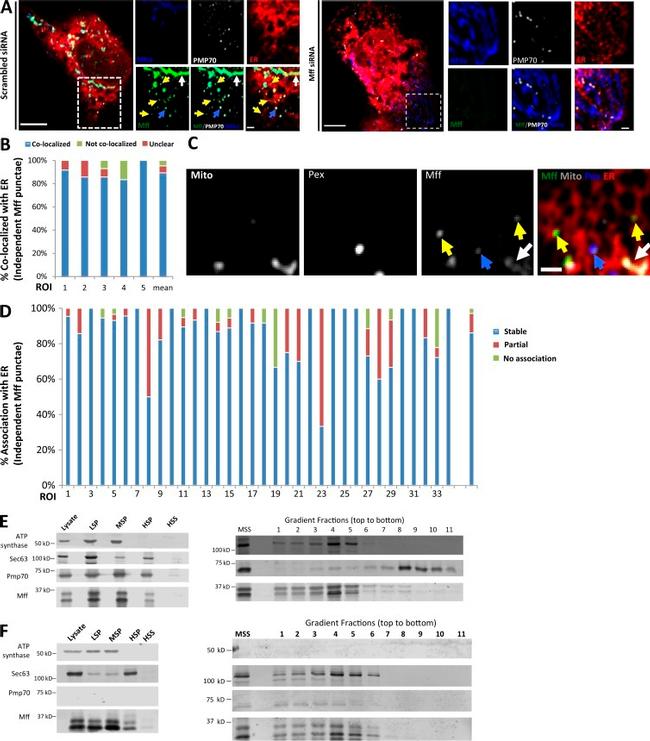 ATP Synthase beta Antibody in Western Blot (WB)