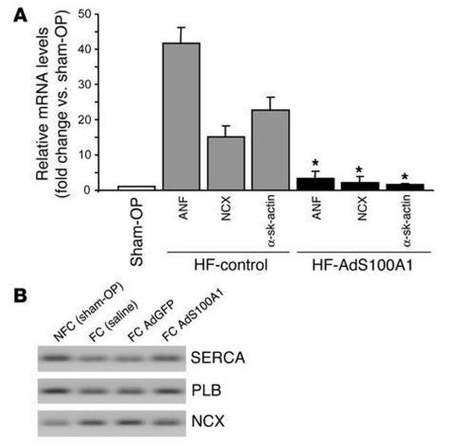 Sodium/Calcium Exchanger Antibody in Western Blot (WB)