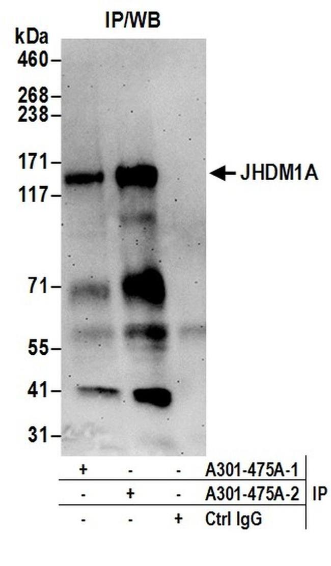 JHDM1A Antibody in Western Blot (WB)