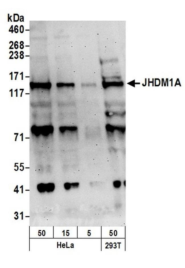 JHDM1A Antibody in Western Blot (WB)