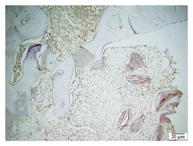 Collagen IV Antibody in Immunohistochemistry (IHC)