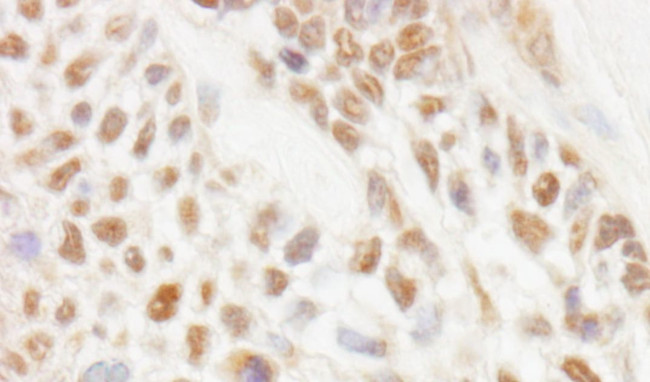 JMJD1C Antibody in Immunohistochemistry (IHC)