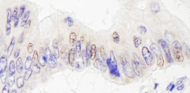 JMJD2A Antibody in Immunohistochemistry (IHC)