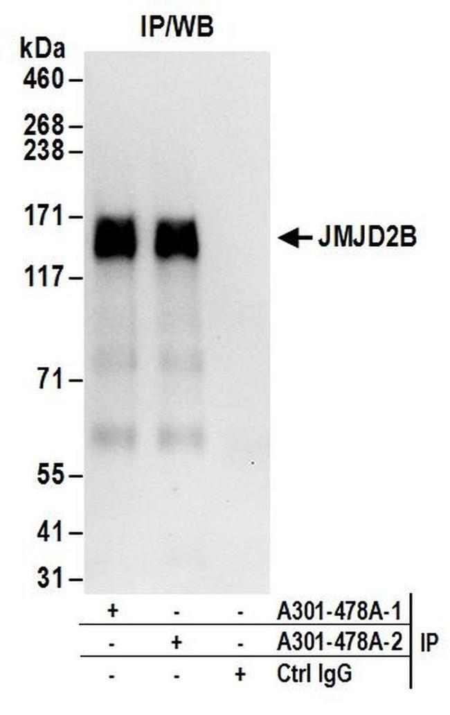 JMJD2B Antibody in Western Blot (WB)