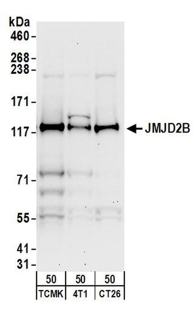 JMJD2B Antibody in Western Blot (WB)