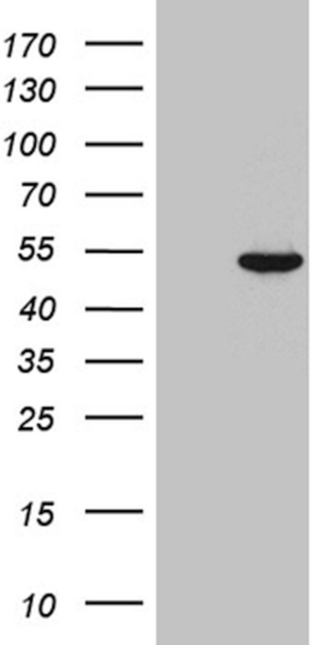 JMJD5 Antibody in Western Blot (WB)