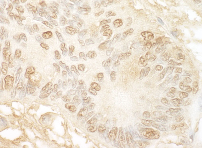 JMY Antibody in Immunohistochemistry (IHC)