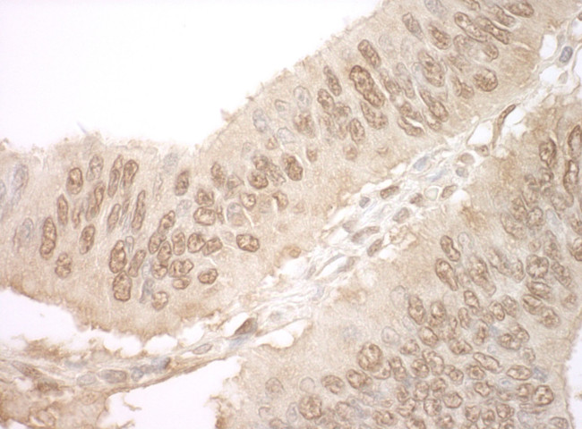 JMY Antibody in Immunohistochemistry (IHC)