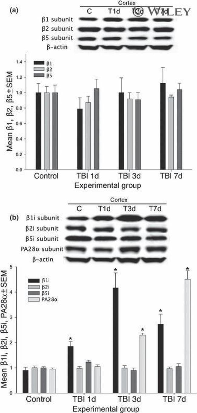 PSME1 Antibody in Western Blot (WB)