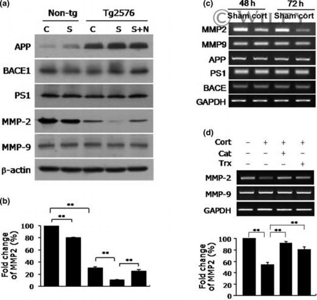 beta Amyloid Antibody in Western Blot (WB)