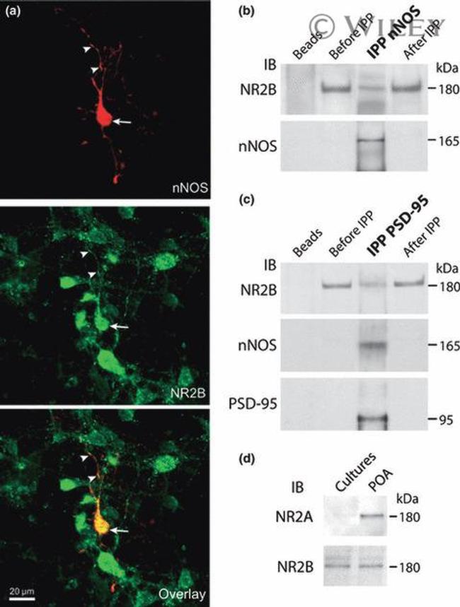 NMDAR2B Antibody in Western Blot, Immunocytochemistry (WB, ICC/IF)