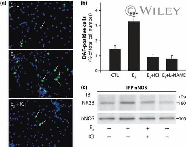 NMDAR2B Antibody in Western Blot (WB)