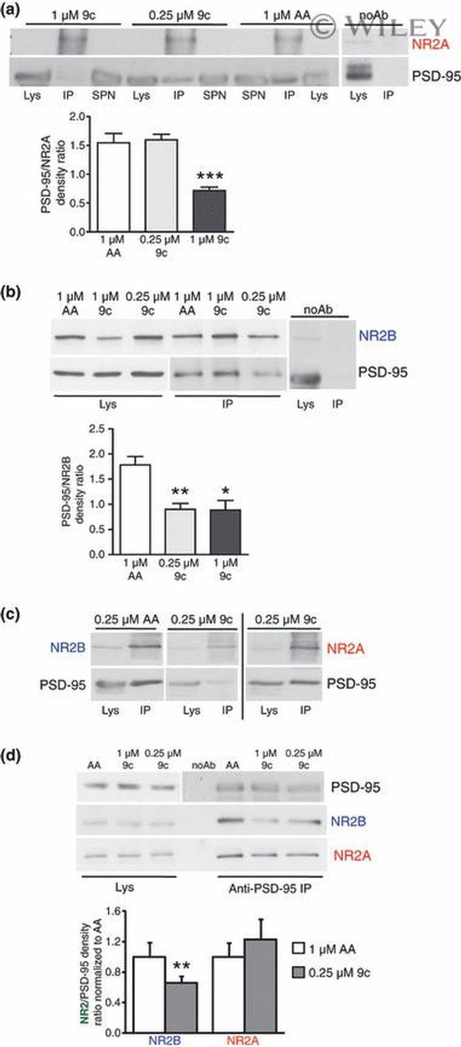 NMDAR2B Antibody in Western Blot (WB)