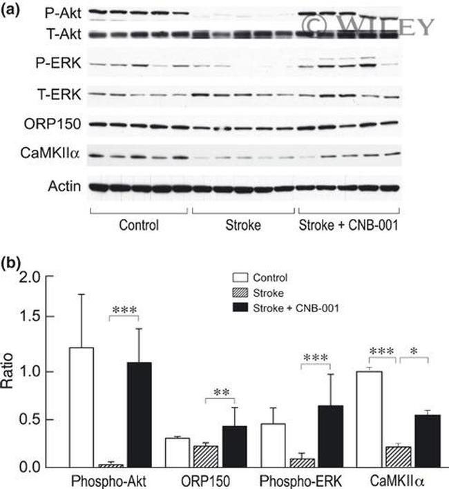 CaMKII alpha Antibody in Western Blot (WB)