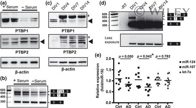 PTBP1 Antibody in Western Blot (WB)