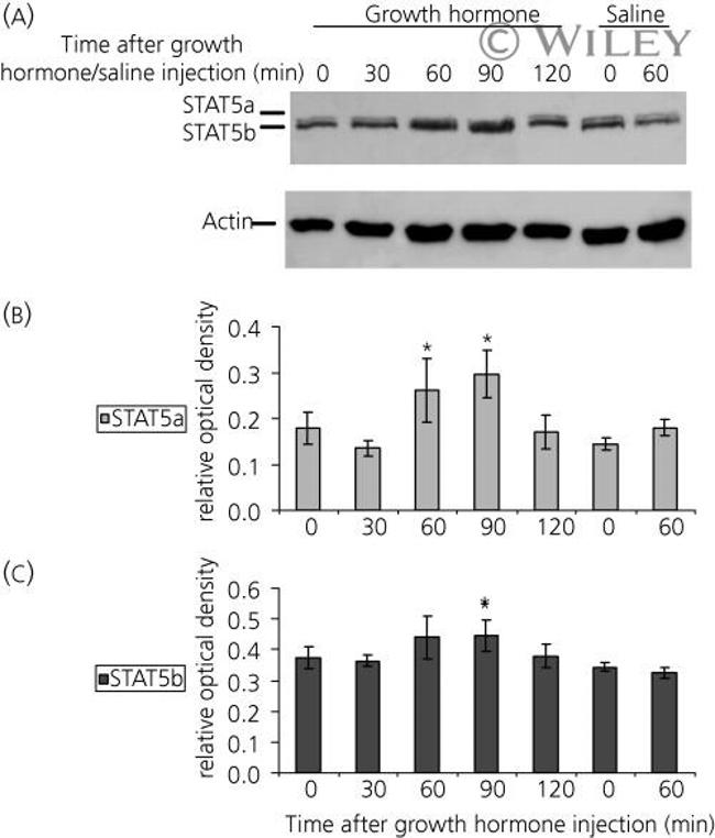 STAT5 beta Antibody in Western Blot (WB)