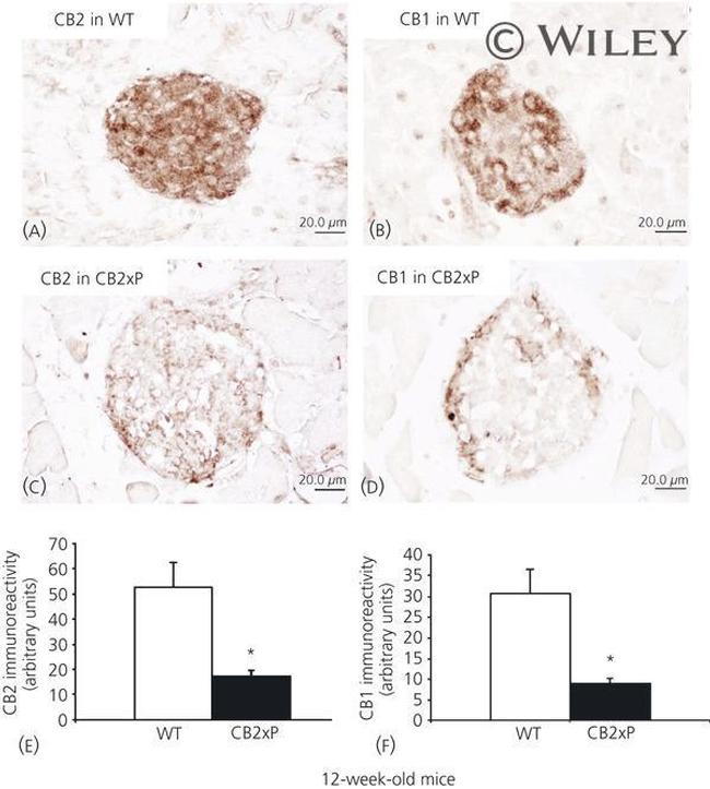 CNR2 Antibody in Immunohistochemistry (Paraffin) (IHC (P))