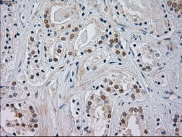 JNK1 Antibody in Immunohistochemistry (Paraffin) (IHC (P))