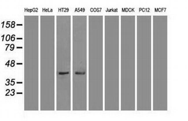 JNK1 Antibody in Western Blot (WB)