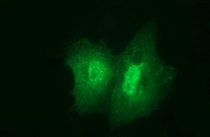 JPH2 Antibody in Immunocytochemistry (ICC/IF)