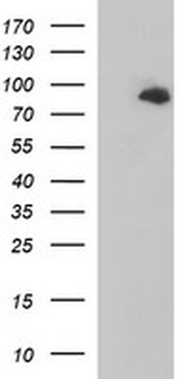 JPH2 Antibody in Western Blot (WB)