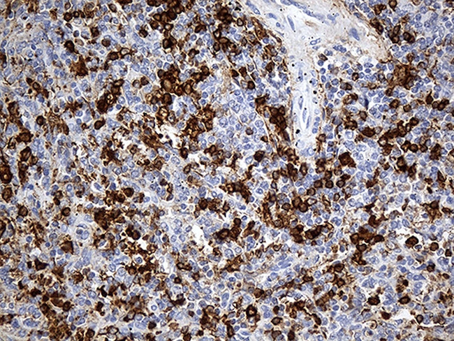 JUP Antibody in Immunohistochemistry (Paraffin) (IHC (P))