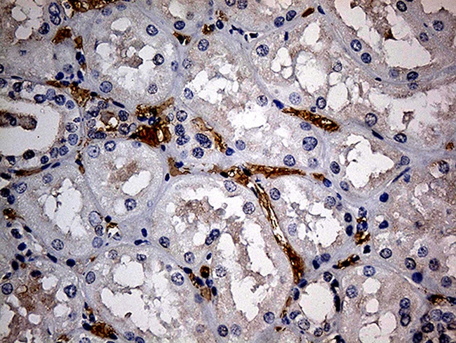 JUP Antibody in Immunohistochemistry (Paraffin) (IHC (P))