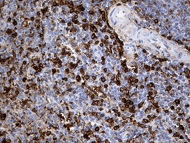 JUP Antibody in Immunohistochemistry (Paraffin) (IHC (P))