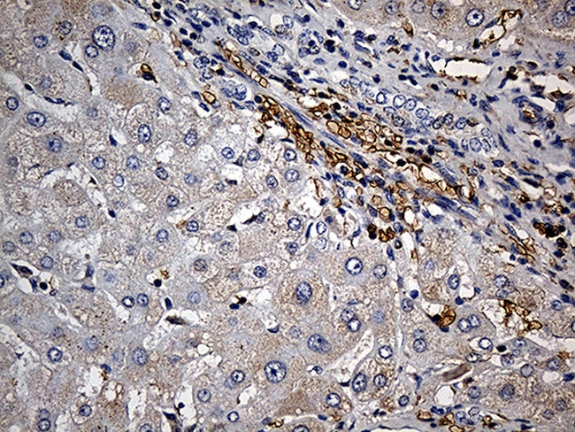 JUP Antibody in Immunohistochemistry (Paraffin) (IHC (P))