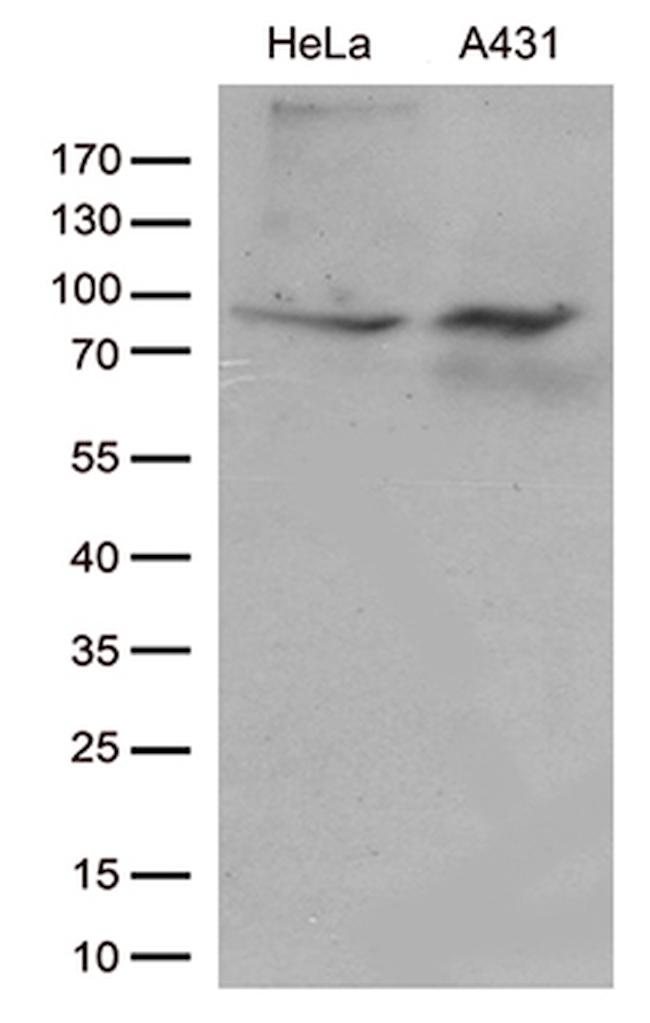 JUP Antibody in Western Blot (WB)