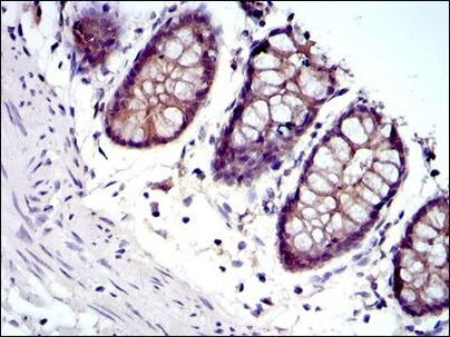 gamma Catenin Antibody in Immunohistochemistry (Paraffin) (IHC (P))