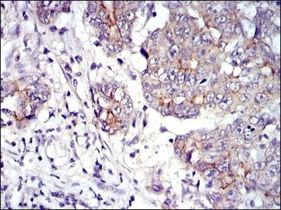 gamma Catenin Antibody in Immunohistochemistry (Paraffin) (IHC (P))