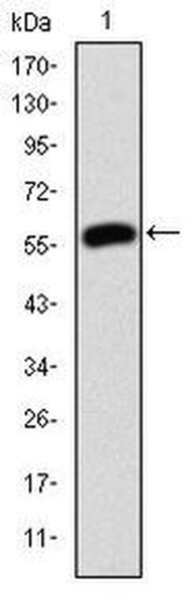 gamma Catenin Antibody in Western Blot (WB)