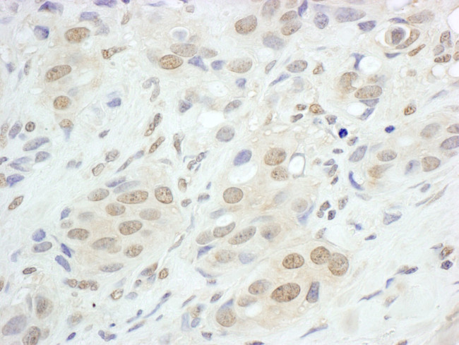 JunB Antibody in Immunohistochemistry (IHC)