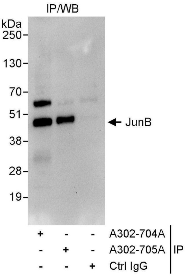 JunB Antibody in Immunoprecipitation (IP)