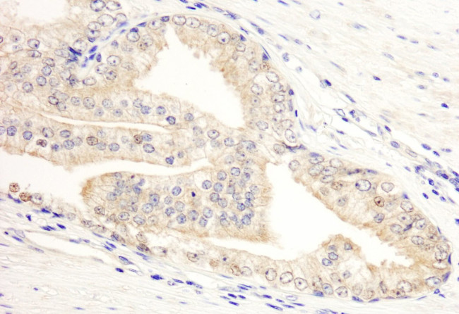 KANK2/SIP Antibody in Immunohistochemistry (IHC)