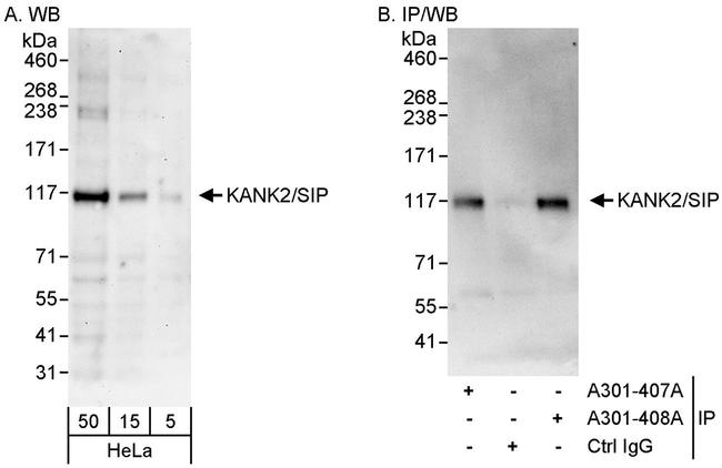 KANK2/SIP Antibody in Western Blot (WB)