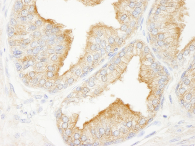 KANK2/SIP Antibody in Immunohistochemistry (IHC)