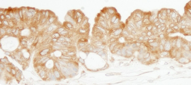 KARS Antibody in Immunohistochemistry (IHC)