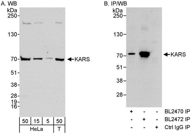 KARS Antibody in Western Blot (WB)