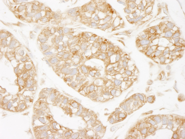 KARS Antibody in Immunohistochemistry (IHC)