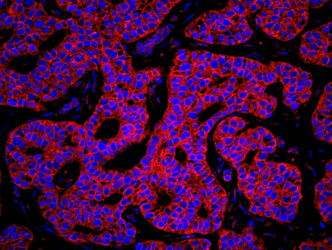 KARS Antibody in Immunohistochemistry (IHC)