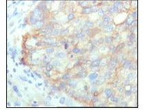 KARS Antibody in Immunohistochemistry (Paraffin) (IHC (P))