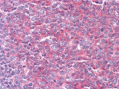 KARS Antibody in Immunohistochemistry (Paraffin) (IHC (P))