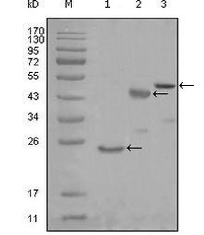 KARS Antibody in Western Blot (WB)