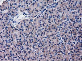 KATNAL1 Antibody in Immunohistochemistry (Paraffin) (IHC (P))