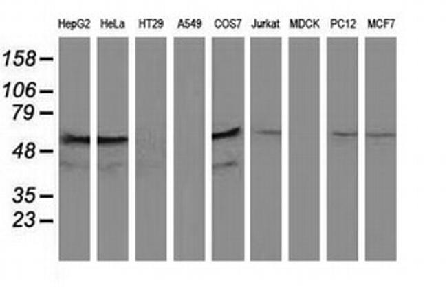 KATNAL1 Antibody in Western Blot (WB)