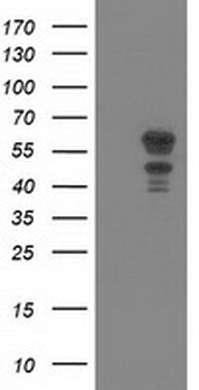 KATNAL1 Antibody in Western Blot (WB)