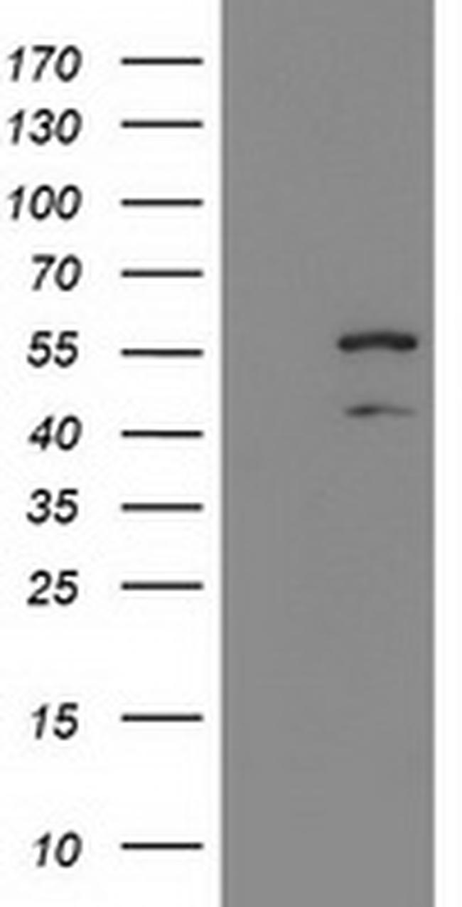 KATNAL1 Antibody in Western Blot (WB)