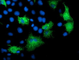 KATNB1 Antibody in Immunocytochemistry (ICC/IF)